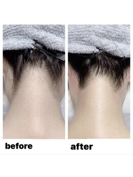 ボニー 新越谷店(GINZA Bonny)/うなじＷＡＸ/光脱毛/ＭＩＸ脱毛