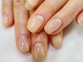 ジェル育成