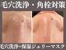 角栓/黒ずみ/皮脂汚れ撃退&白玉肌！毛穴洗浄+ジェリ-パック¥17600→¥4620