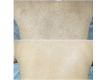 エレファンテブランコ(Elefante Blanco)