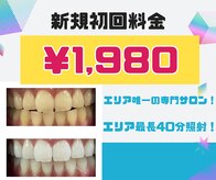 ホワイトニングサロン アース 福知山店(EARTH)