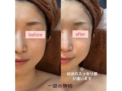 ルミナス(LUMINOUS)の写真