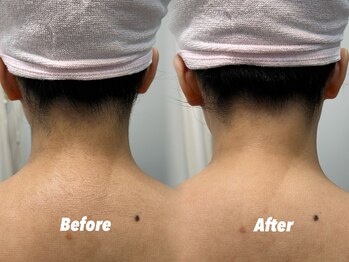 クイーン 渋谷店(QUEEN)/形は人それぞれです