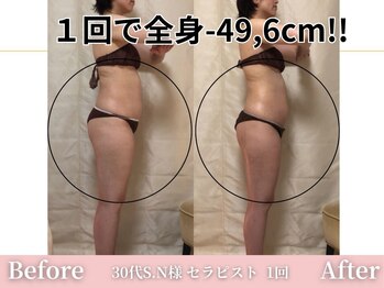 アメリイ 百合ヶ丘 新百合ヶ丘(Amerii)/【痩身】1回全身-49.6センチ痩せ