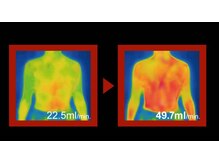 施術後のビフォーアフターです。ぽかぽかになります！