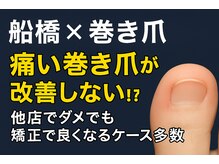巻き爪じゅん 千葉駅前店/巻き爪が改善しない理由とは？