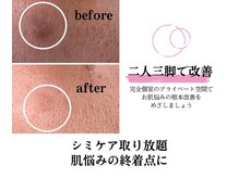 お肌の悩みの終着点サロン