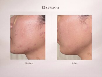 ベルミナ(Belmina)/