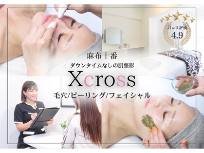 クロス(Xcross)の写真