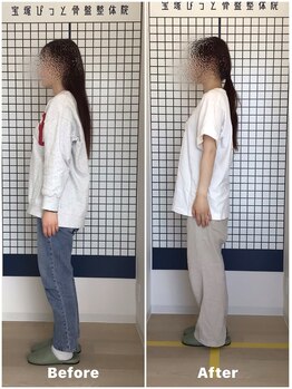 宝塚ぴっと骨盤整体院の写真/朝起きた時の辛い腰痛に！産後・デスクワークの骨盤の歪みは骨盤矯正で解消♪