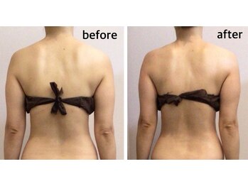 ネロリ(Neroli)の写真/【本格痩身マシン導入】今すぐ!!本気の痩身エステで、気になる凸凹セルライトや脂肪を燃焼!