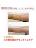10月限定★35％OFF【二の腕全周】ダウンタイムインディバ 60分15,000→
