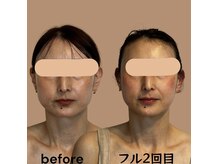 ルース(LUCE)の雰囲気（骨格自体を整えて綺麗な卵型小顔へ。）