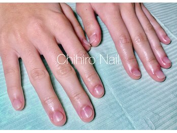 チヒロネイル/爪噛みによる深爪改善