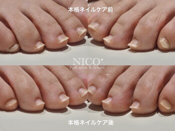 ニコプラス(NICO+)/爪育ネイルケア