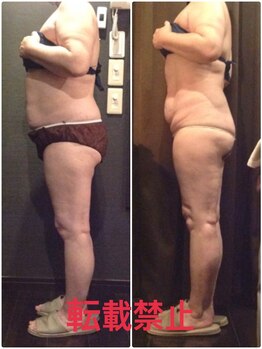 プラチナアース 守谷店(Platinum earth)/痩身ビフォーアフター