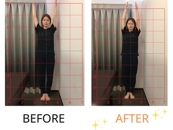ベル/20代の方の姿勢Before After