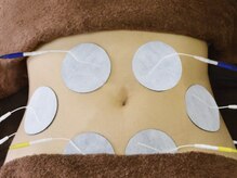 鶴亀接骨院 ボディコンディショニング研究所/EMS