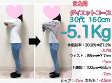 美骨矯正 ステキプロ(SUTEKI pro)