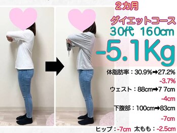 美骨矯正 ステキプロ(SUTEKI pro)の写真/もう隠さなくていい!整体×痩身のWアプローチで効果◎ダイエットが続かなかった方でも着たい服が似合う体へ