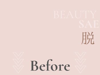 サエラ(SAERA)/脱毛ビフォーアフター集