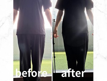 ヴレ 福岡店(Vraie)/O脚もスッキリ真っ直ぐに!