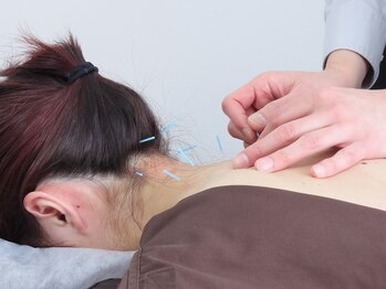 中野区の鍼灸院PICTURE(ピクチャー)沼袋-新井薬師前駅/こりにこった首肩をほぐします