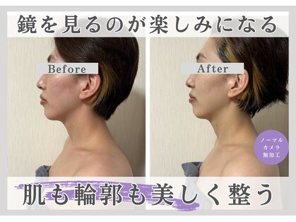 ルリアン(Lurian)の写真