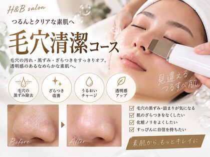 エイチ アンド ビー(H&B)の写真