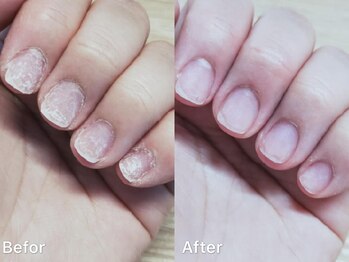 ネイルアート エクリ(Nail Art:Ecrit)/【爪育：たんぱく質修復ケア】