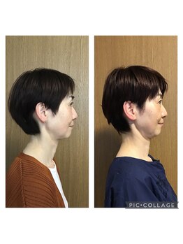 マカニ 河原町御池(makani)/小顔矯正ビフォーアフター