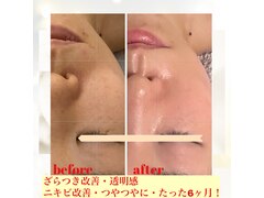 麻布total beaty salon パラジェルネイル/アイラッシュ/小顔 ヌーボーモイ nouveaumoi