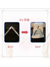 和ぎ整体院/肋骨矯正で改善