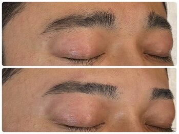 リジョーナ 岐南店(Lijona)/垂れ眉矯正