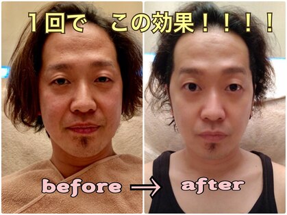 宝塚山手メンズサロンの写真