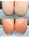 シトリン(Sitrine)の写真/【美容大国最新技術】韓国式足裏角質ケア★新導入～PEDIPLANING～自分史上最高のつるすべフット