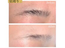 サンティエ(Scintiller)の雰囲気(眉周りの脱毛もお任せください。もみあげ、鼻入口も大人気!)