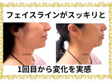 カルナー 武蔵小杉