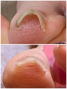 リネイル 長浜(Re-na-iL)/ネイルケア＆スパ¥7000