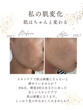 エフリア 大垣(F.lia)/ホームケアでここまで変わる！