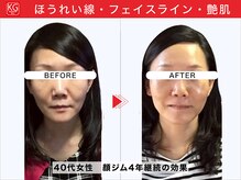 那賀洋子式 顔ジム 大分戸次店/小顔矯正顔ジム継続の効果