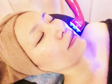 ビューティルームリチェ(Ri‐che)/★エイジングケアコース