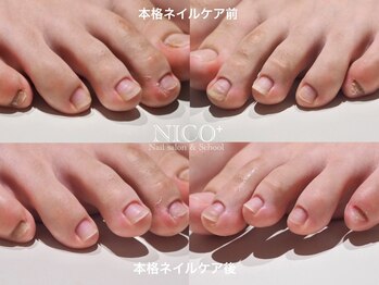 ニコプラス(NICO+)/爪育ネイルケア