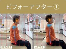 南柏駅前整骨院/ビフォーアフター１