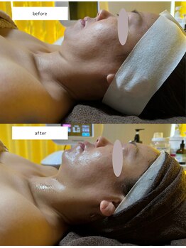 薫風/サーマトリックス/50代