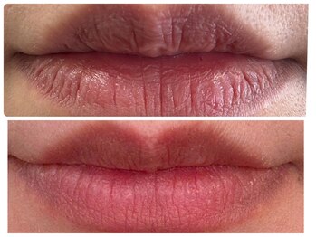 ヒメミ(Himemi)/ローマピンク 唇