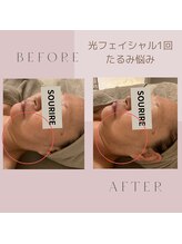 スリール 吉祥寺店(Sourire)/たるみ悩み