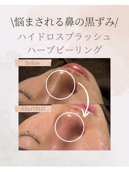 ビレボ マエバシ(BEREVO maebashi)/Before After