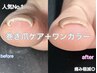 【人気◎】巻き爪ケア1本+美フォルムワンカラー¥13,000(通常¥14,700)
