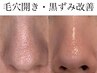 【7月限定メニュー】感動/実感 毛穴開き・毛穴の黒ずみ・たるみ毛穴改善